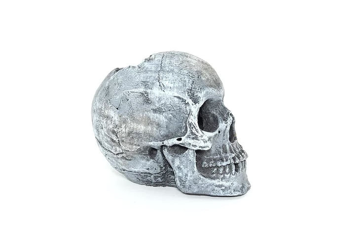 cranio_3